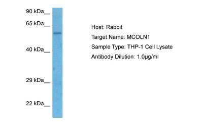 Western Blot: Mucolipin 1 Antibody [NBP2-87859]