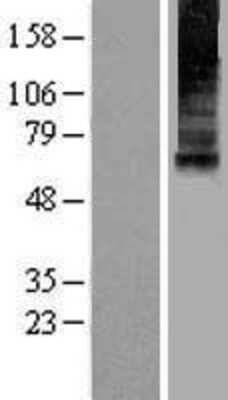 Western Blot: Mucolipin 1 Overexpression Lysate [NBL1-12958]