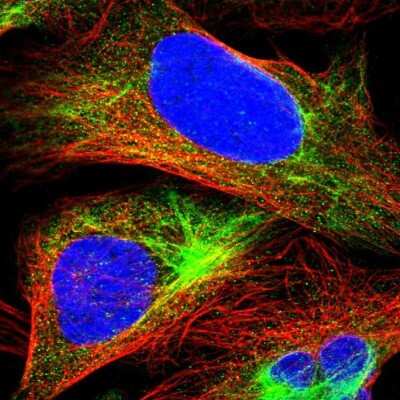 Immunocytochemistry/ Immunofluorescence: Mucolipin 2 Antibody [NBP1-89830]