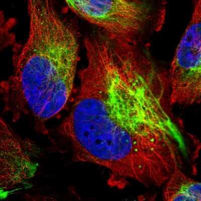 Immunocytochemistry/ Immunofluorescence: Mucolipin 2 Antibody [NBP2-54986]