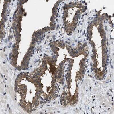 Immunohistochemistry-Paraffin: Mucolipin 2 Antibody [NBP1-89830]