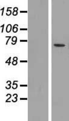 Western Blot: Mucolipin 2 Overexpression Lysate [NBP2-05268]