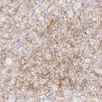 Immunohistochemistry: Mucolipin 3 Antibody [NBP2-38951]