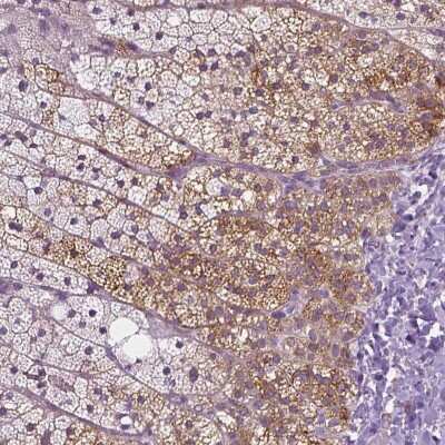 Immunohistochemistry-Paraffin: Mucolipin 3 Antibody [NBP1-83791]