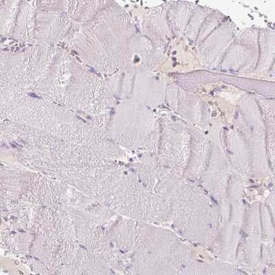 Immunohistochemistry-Paraffin: Mucolipin 3 Antibody [NBP1-83791]