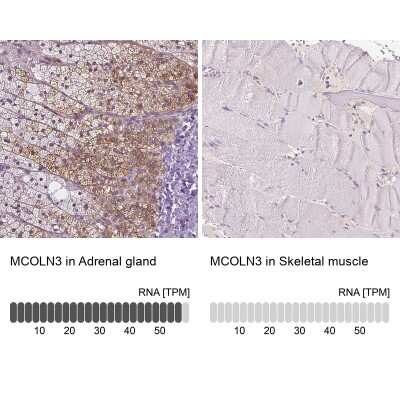 Immunohistochemistry-Paraffin: Mucolipin 3 Antibody [NBP1-83791]