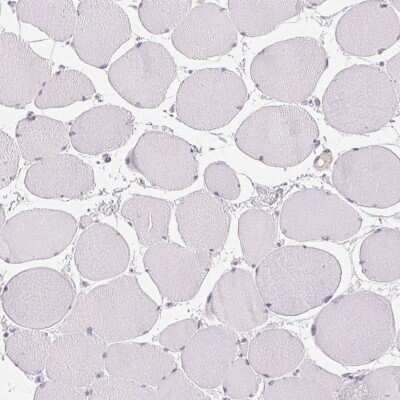 Immunohistochemistry-Paraffin: Mucolipin 3 Antibody [NBP2-38951]