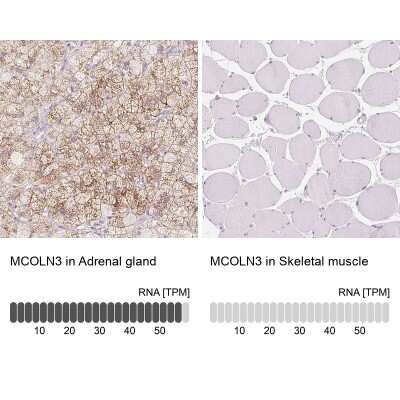 Immunohistochemistry-Paraffin: Mucolipin 3 Antibody [NBP2-38951]