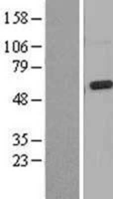 Western Blot: Mucolipin 3 Overexpression Lysate [NBL1-12960]