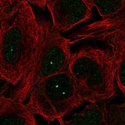 Immunocytochemistry/ Immunofluorescence: Multicilin Antibody [NBP2-58381]