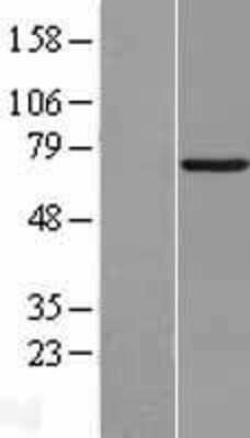 Western Blot: Syntaxin-BP3/Munc18c Overexpression Lysate [NBL1-16588]