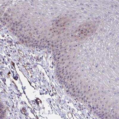 Immunohistochemistry-Paraffin: Mus81 Antibody [NBP2-32474]