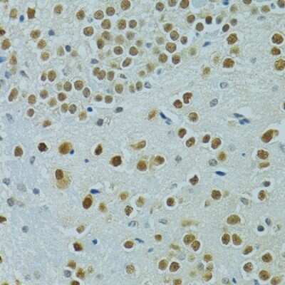 Immunohistochemistry-Paraffin: Mus81 Antibody - BSA Free [NBP2-95212]