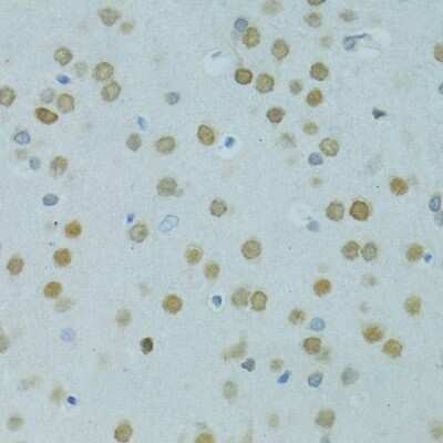 Immunohistochemistry-Paraffin: Mus81 Antibody - BSA Free [NBP2-95212]