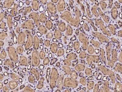 Immunohistochemistry-Paraffin: Mus81 Antibody [NBP2-97261]