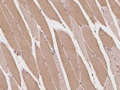 Immunohistochemistry-Paraffin: Mus81 Antibody [NBP2-97261]