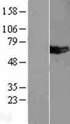 Western Blot: Mus81 Overexpression Lysate [NBL1-13396]