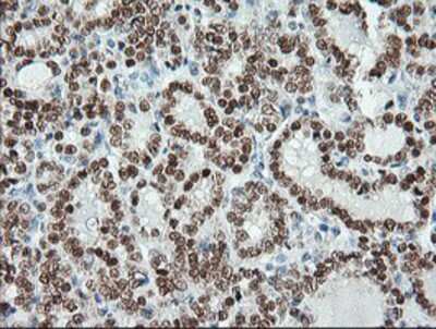 Immunohistochemistry-Paraffin: Musashi-1 Antibody (OTI1G8) [NBP2-03434]