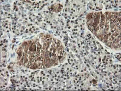 Immunohistochemistry-Paraffin: Musashi-1 Antibody (OTI1G8) [NBP2-03434]