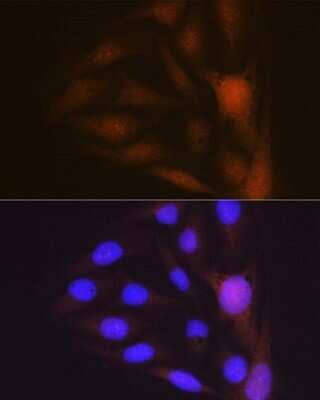 Immunocytochemistry/ Immunofluorescence: Musashi-1 Antibody (9S7Y1) [NBP3-16754]