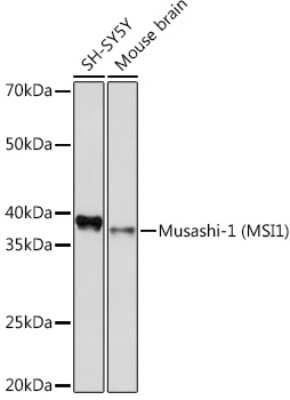 Western Blot: Musashi-1 Antibody (9S7Y1) [NBP3-16754]