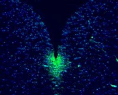 Immunocytochemistry/ Immunofluorescence: Musashi-1 Antibody - BSA Free [NB100-1759]