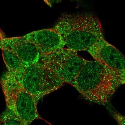 Immunocytochemistry/ Immunofluorescence: Musashi-1 Antibody [NBP2-57163]