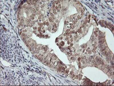 Immunohistochemistry: Musashi-1 Antibody (OTI1G8) - Azide and BSA Free [NBP2-72828]