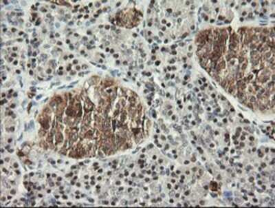 Immunohistochemistry: Musashi-1 Antibody (OTI1G8) - Azide and BSA Free [NBP2-72828]