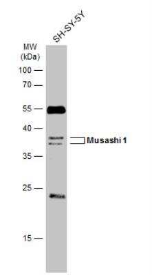 Western Blot: Musashi-1 Antibody [NBP1-32812]