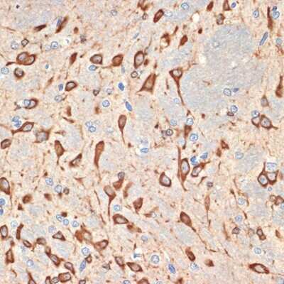Immunohistochemistry-Paraffin: Musashi-2 Antibody (7L4E9) [NBP3-15935]