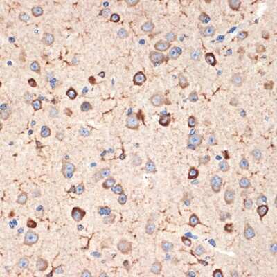 Immunohistochemistry-Paraffin: Musashi-2 Antibody (7L4E9) [NBP3-15935]