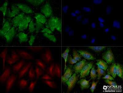 Immunocytochemistry/ Immunofluorescence: Musashi-2 Antibody - BSA Free [NBP2-52978]
