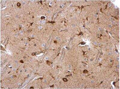 Immunohistochemistry-Paraffin: Musashi-2 Antibody [NBP2-19443]