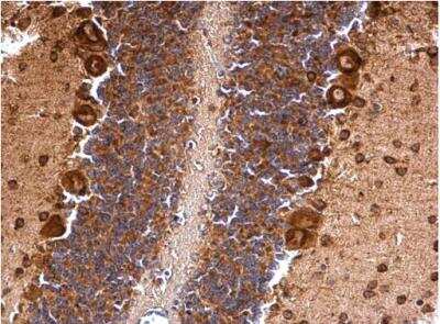 Immunohistochemistry-Paraffin: Musashi-2 Antibody [NBP2-19443]