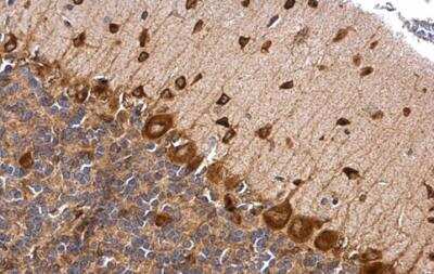 Immunohistochemistry-Paraffin: Musashi-2 Antibody [NBP2-19443]