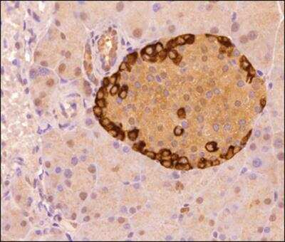 Immunohistochemistry-Paraffin: Musashi-2 Antibody - BSA Free [NBP2-52978]