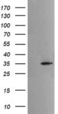 Western Blot: Musashi-2 Antibody (OTI2F10)Azide and BSA Free [NBP2-72836]