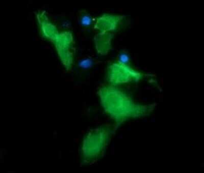 Immunofluorescence: Musashi-2 Antibody (OTI2F10) [NBP2-45837]