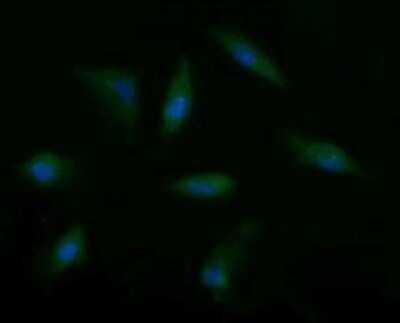 Immunofluorescence: Musashi-2 Antibody (OTI2F10) [NBP2-45837]