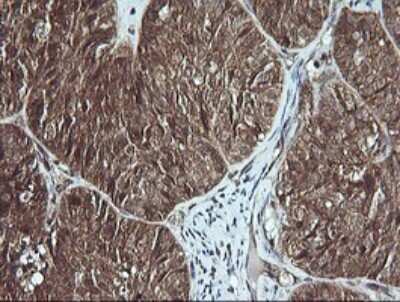 Immunohistochemistry: Musashi-2 Antibody (OTI2F10) [NBP2-45837]