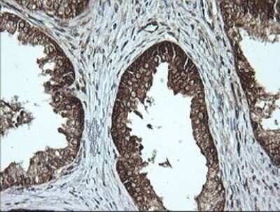 Immunohistochemistry: Musashi-2 Antibody (OTI2F10) [NBP2-45837]