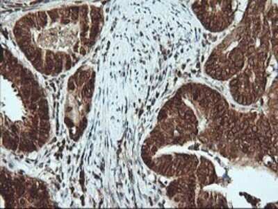 Immunohistochemistry: Musashi-2 Antibody (OTI2F10) [NBP2-45837]