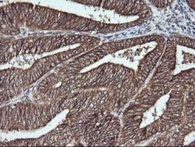 Immunohistochemistry: Musashi-2 Antibody (OTI2F10) [NBP2-45837]