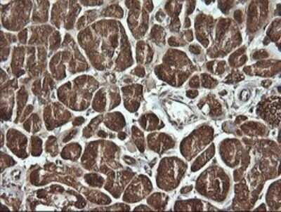 Immunohistochemistry: Musashi-2 Antibody (OTI2F10) [NBP2-45837]