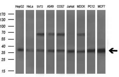 Western Blot: Musashi-2 Antibody (OTI2F10) [NBP2-45837]