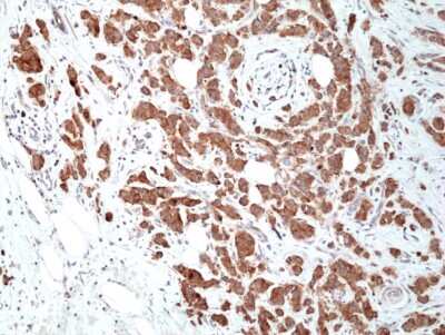 Immunohistochemistry-Paraffin: Musashi-2 Antibody (RM422) [NBP3-09175]