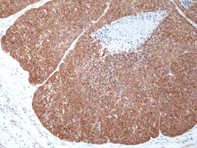 Immunohistochemistry-Paraffin: Musashi-2 Antibody (RM422) [NBP3-09175]