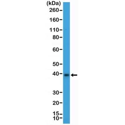 Western Blot: Musashi-2 Antibody (RM422) [NBP3-09175]