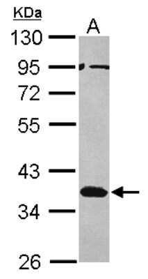 Western Blot: Musashi-2 Antibody [NBP2-19443]